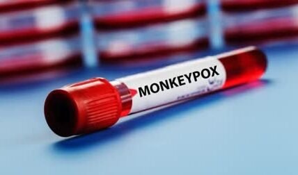 One more person confirmed infected with M-Pox virus in Kerala