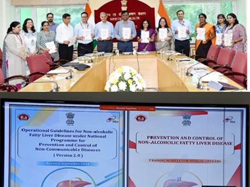 Union Health Ministry issues revised operational and training guidelines for treatment of Non-Alcoholic Fatty Liver Disease (NAFLD)