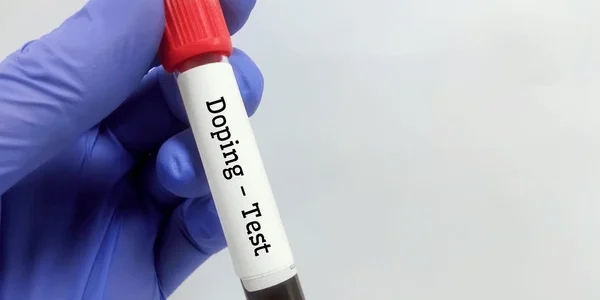 anti-doping testing in sports